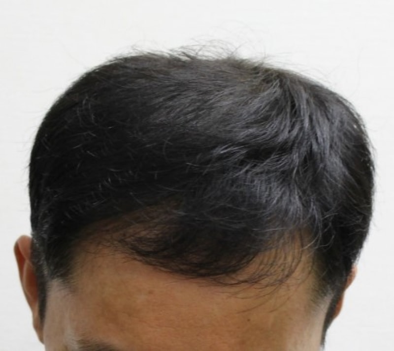 1년.jpg