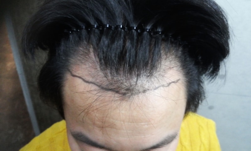 20151125_1756419.jpg