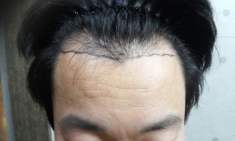20151125_1756365.jpg