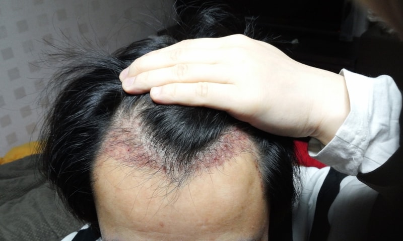 20160123_0700592.jpg