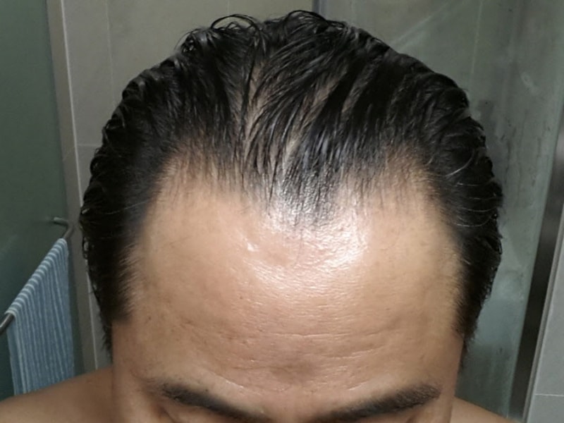 150107.jpg