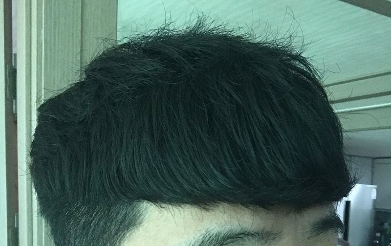 왼쪽.jpg