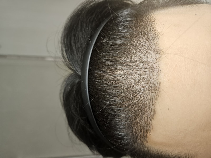 1000036113.jpg