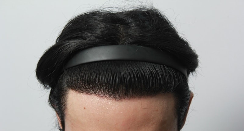 1년경과 15.jpg