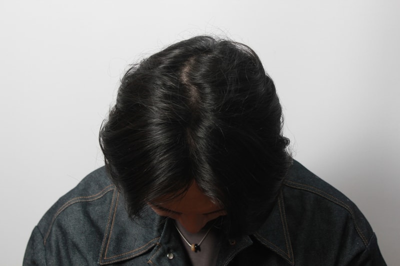 정수리.JPG
