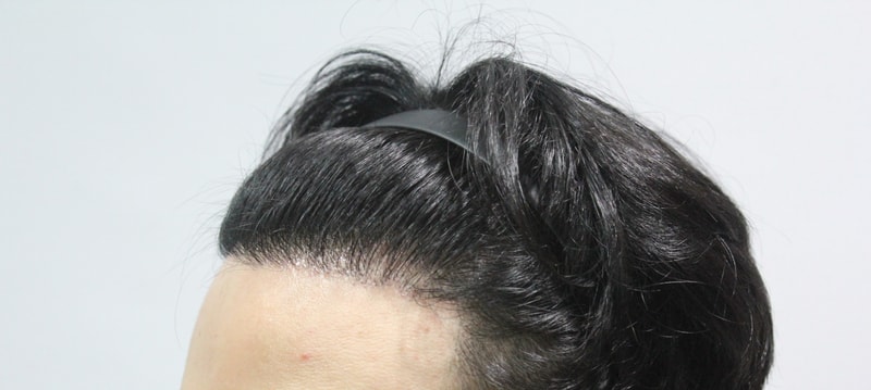 수술 전2.jpg