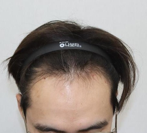 수술 전 1.JPG