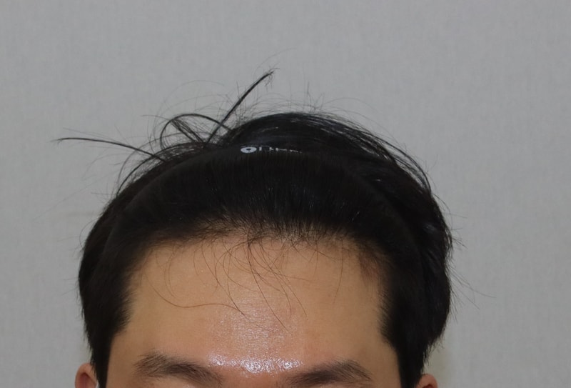 전.JPG