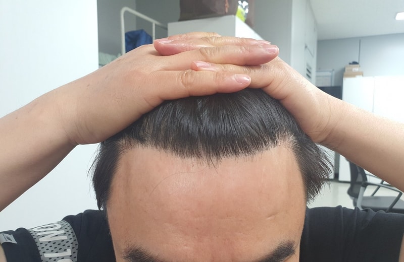 1년.jpg