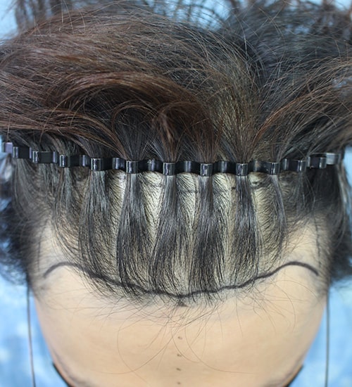 Cut 3150 hair 6 months