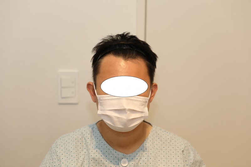 This is the third day of hair transplantation.