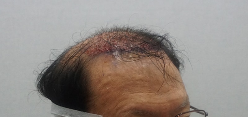 수술직후2.jpg