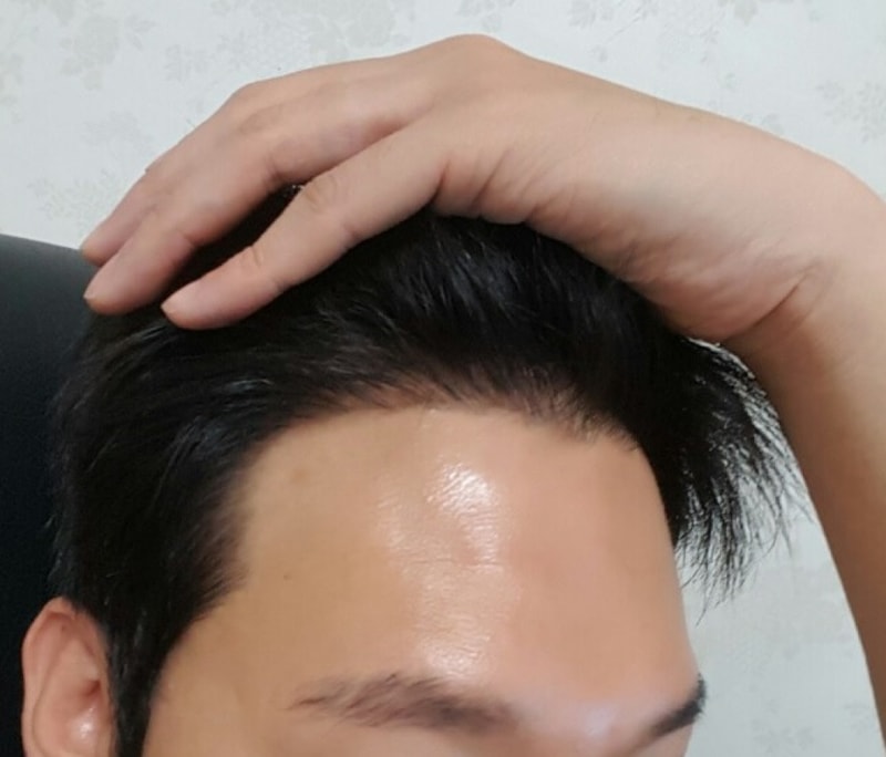 올리고1.jpg