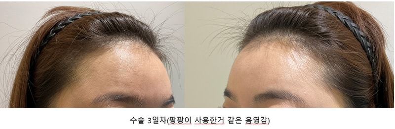 3일차 측면.jpg