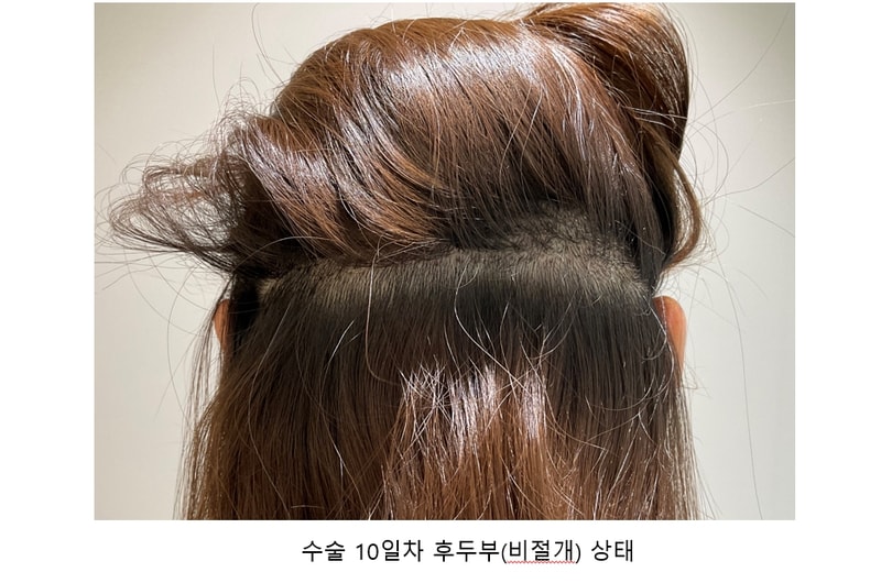 후두부.jpg