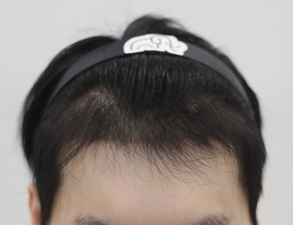4개월.jpg