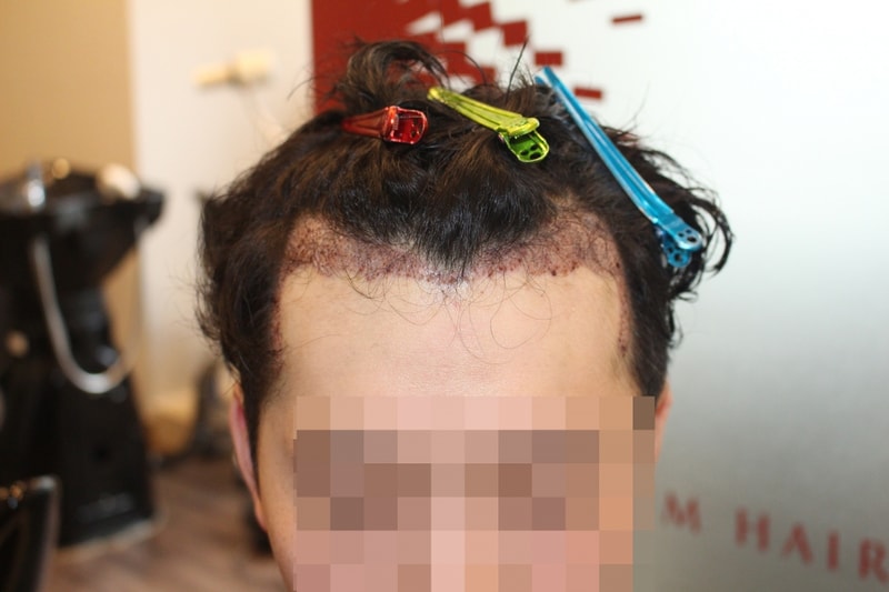 샴푸후.JPG