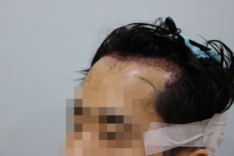 혐주의1.jpg