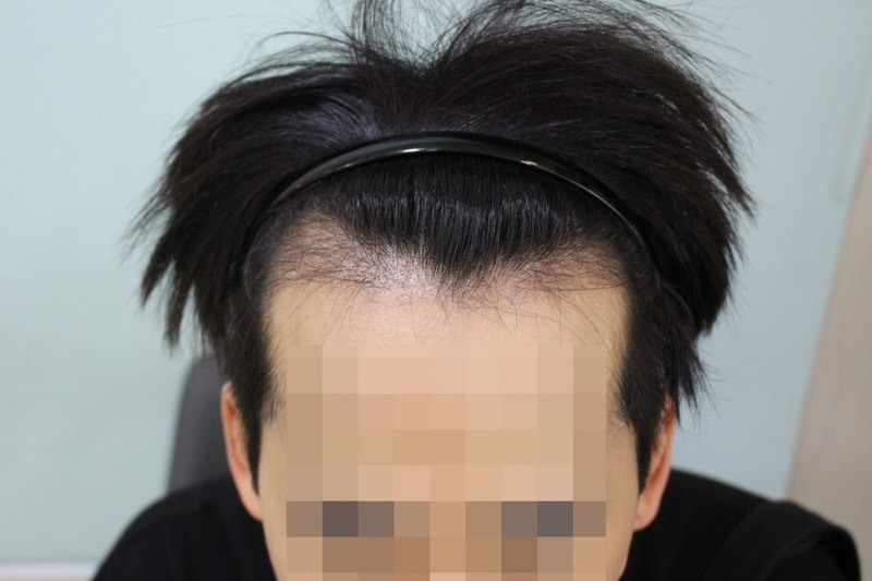 3개월차1.jpg