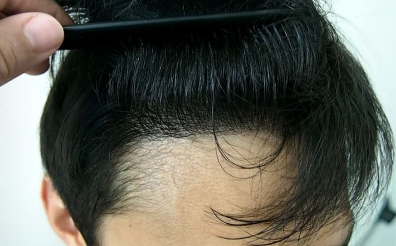 캡처2.JPG