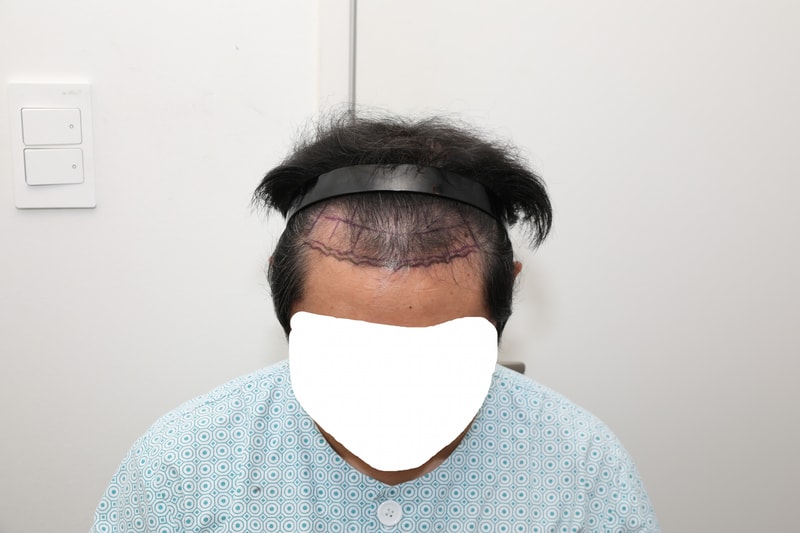 수술전4.jpg