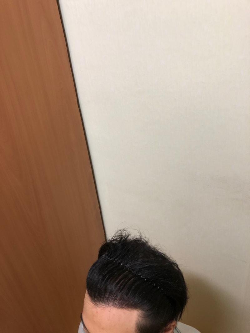 这是出道1年4个月的照片