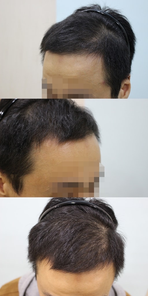 4개월.jpg
