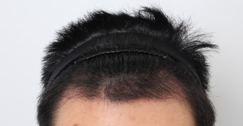 수정정면.jpg
