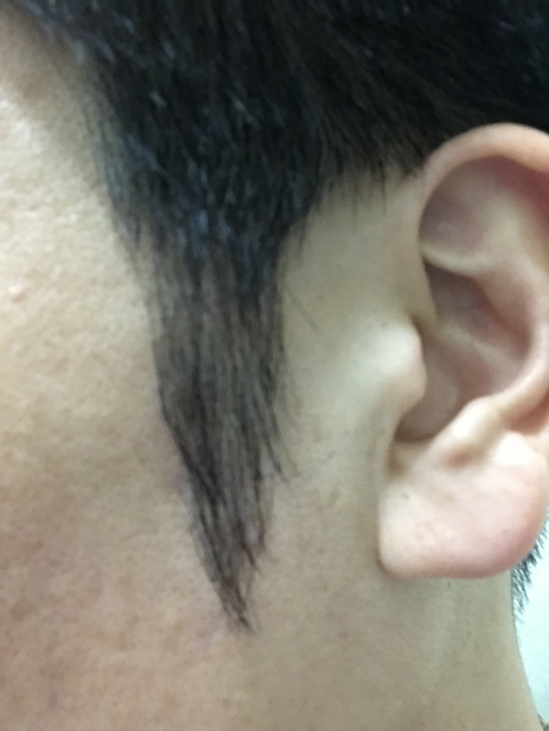 It's a one-year evaluation of Mo Jae-sung. (Sideburns, eyebrows, soldering)