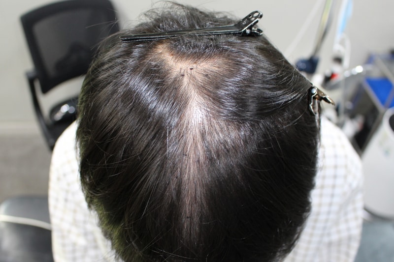 포토후기 이미지