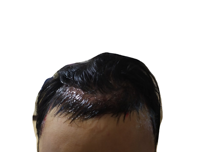 3.png