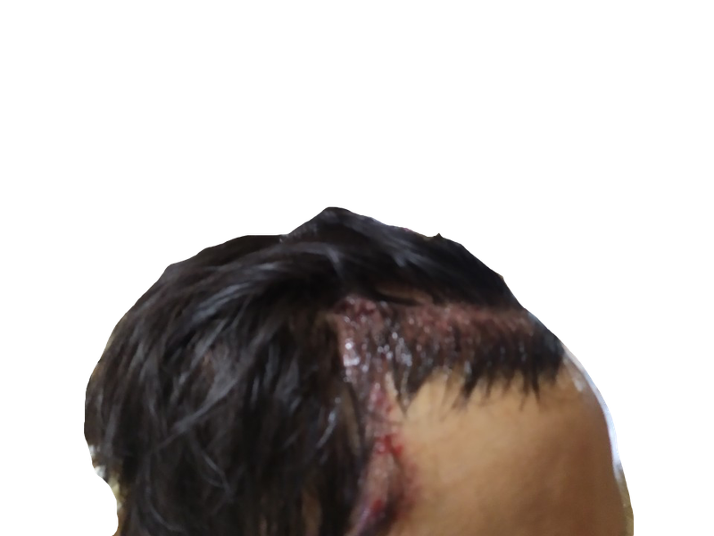 1.png