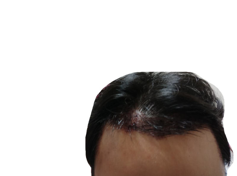 5.png