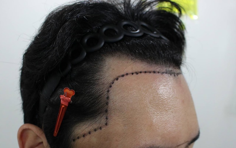 포토후기 이미지