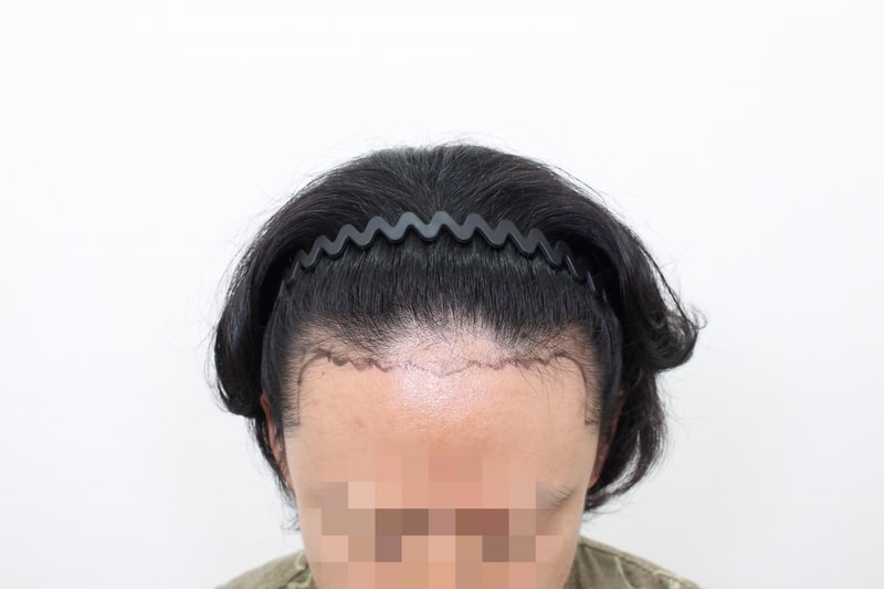 포토후기 이미지