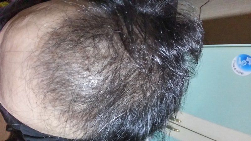 20161124_201113_HDR.jpg