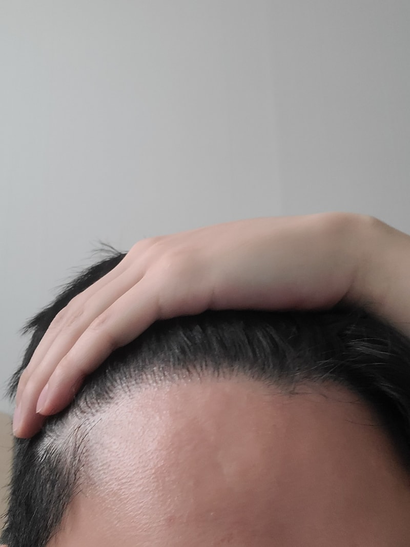 왼쪽.jpg