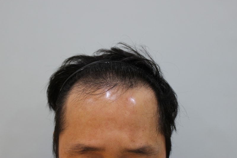 4개월.JPG