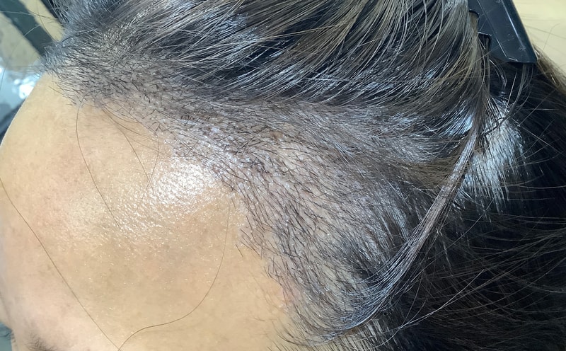 [Growing up] 1655 Hairline Women's Hairline Non-Section Week 2 Review