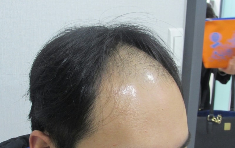 1499223262957-1.jpg