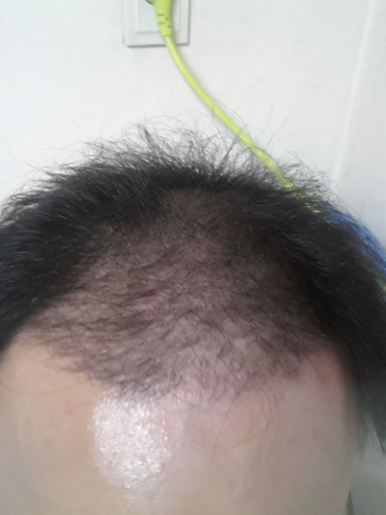 4개월15일뒤1.jpg
