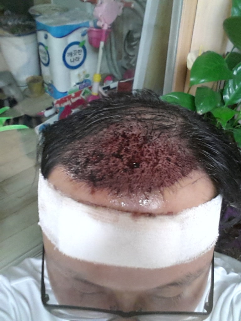 수술후저녁.jpg