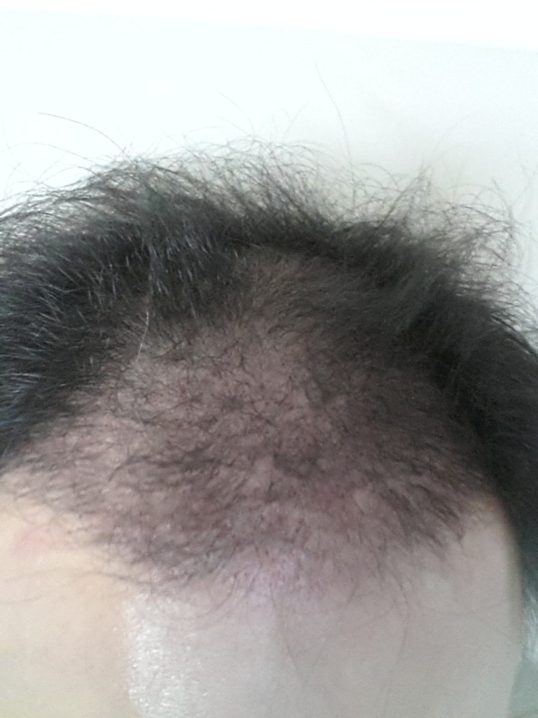 4개월15일뒤2.jpg
