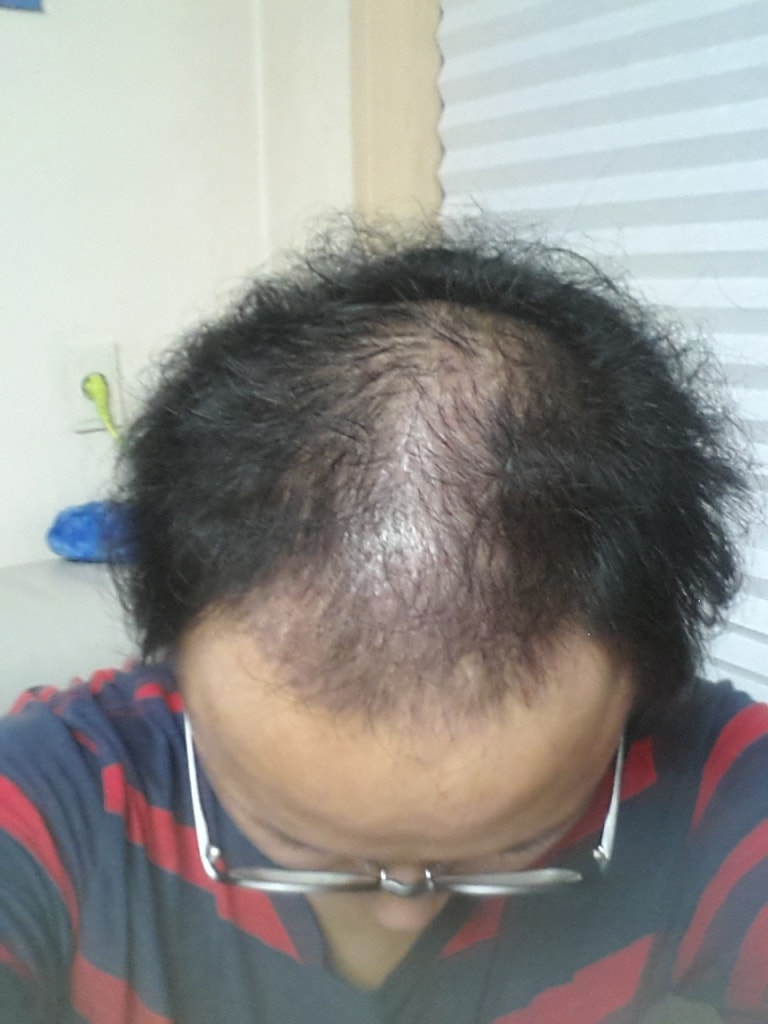 4개월후.jpg