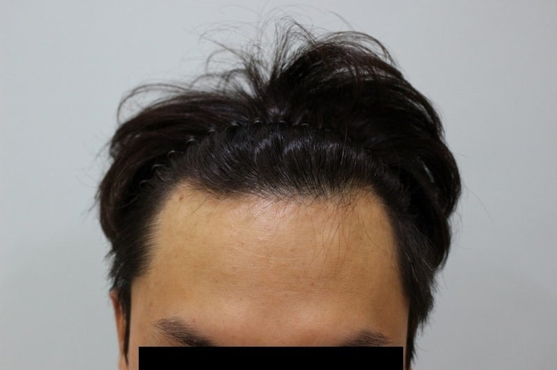 before1.jpg