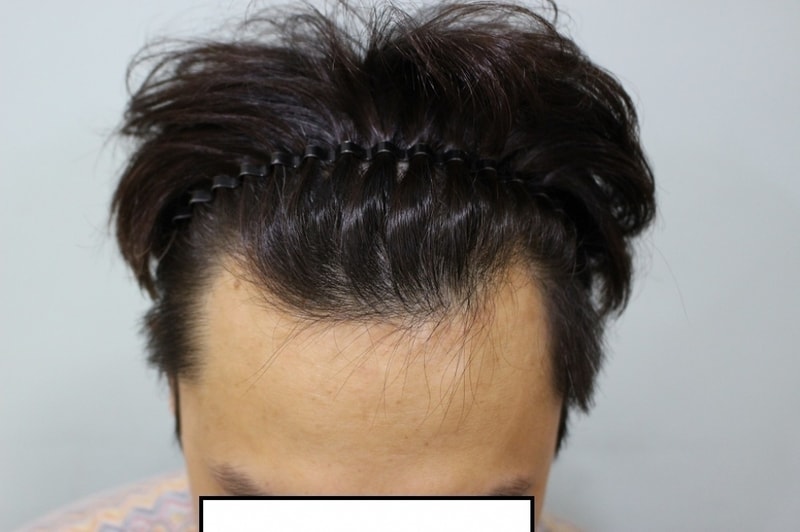 before2.jpg