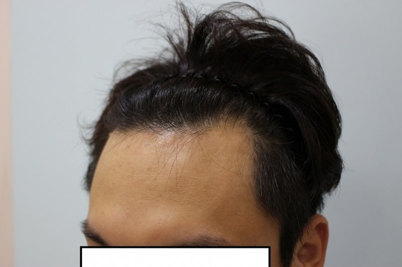 before3.jpg