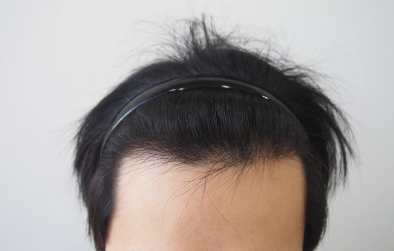 8 Month Evaluation of Parental Non-Cutting