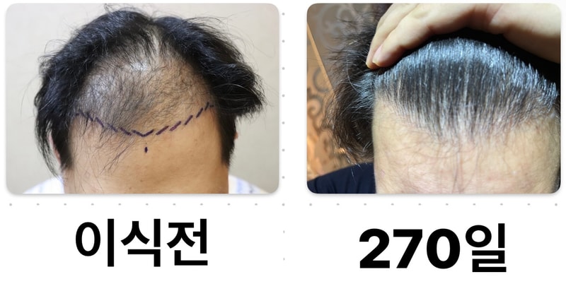 It's been 270 days