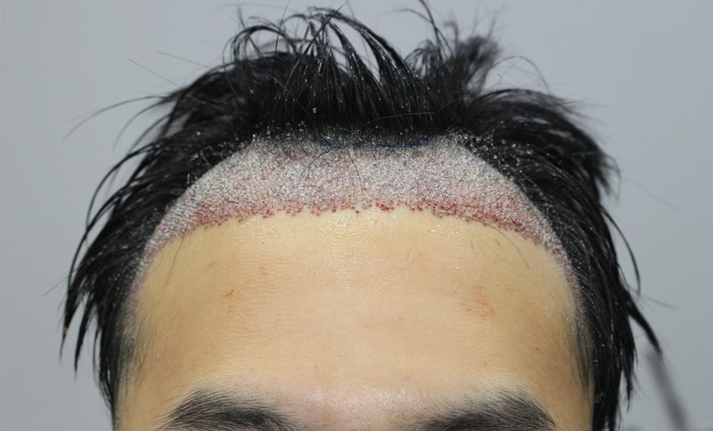 4.수술당일.jpg